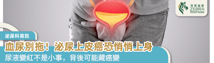 血尿別拖！泌尿上皮癌恐悄悄上身