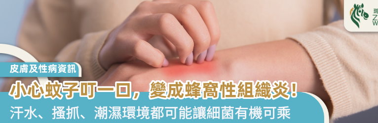 小心蚊子叮一口，變成蜂窩性組織炎！