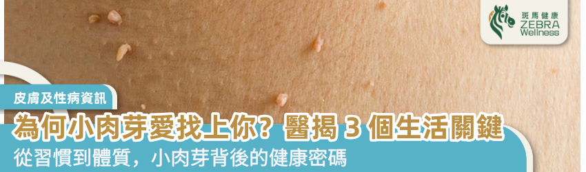 為何小肉芽愛找上你？醫揭 3 個生活關鍵