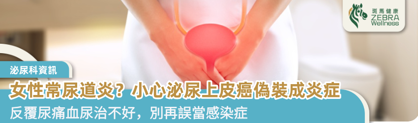 女性常尿道炎？小心泌尿上皮癌偽裝成炎症