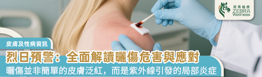 烈日預警：全面解讀曬傷危害與應對