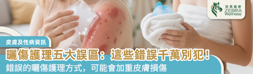曬傷護理的五大誤區：這些錯誤千萬別犯！