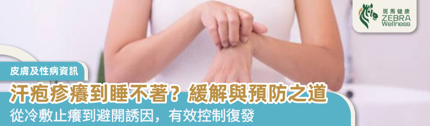 汗疱疹癢到睡不著？緩解與預防之道