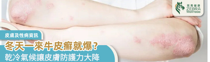 冬天一來牛皮癬就爆？