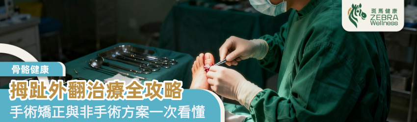拇趾外翻治療全攻略