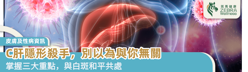C肝隱形殺手，別以為與你無關
