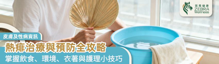 熱痱治療與預防全攻略