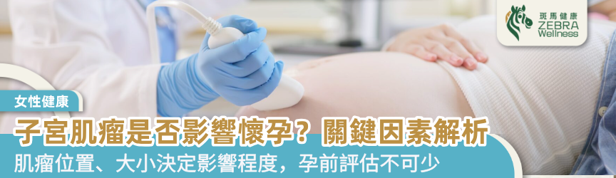 子宮肌瘤是否影響懷孕？關鍵因素解析