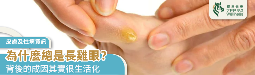 為什麼總是長雞眼？