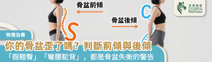 你的骨盆歪了嗎？判斷前傾與後傾