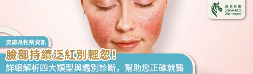 臉部持續泛紅別輕忽！認識玫瑰痤瘡的真相