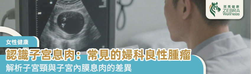 認識子宮息肉：常見的婦科良性腫瘤