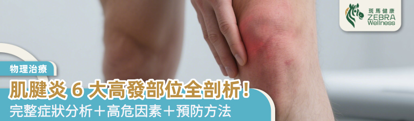 肌腱炎6大高發部位全剖析！