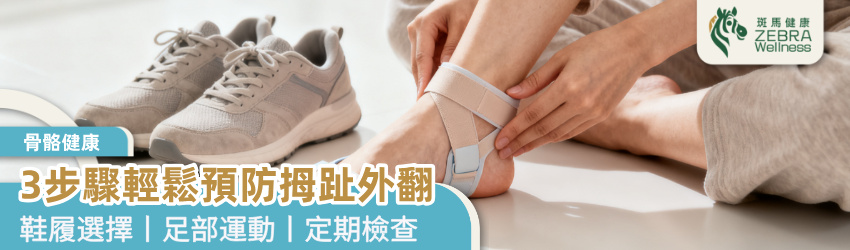 3步驟輕鬆預防拇趾外翻