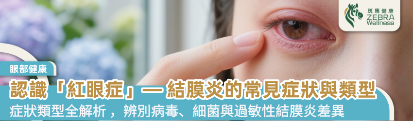 認識「紅眼症」— 結膜炎的常見症狀與類型