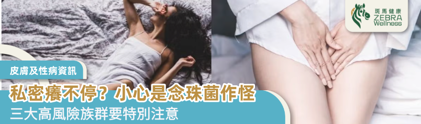 私密癢不停？小心是念珠菌作怪